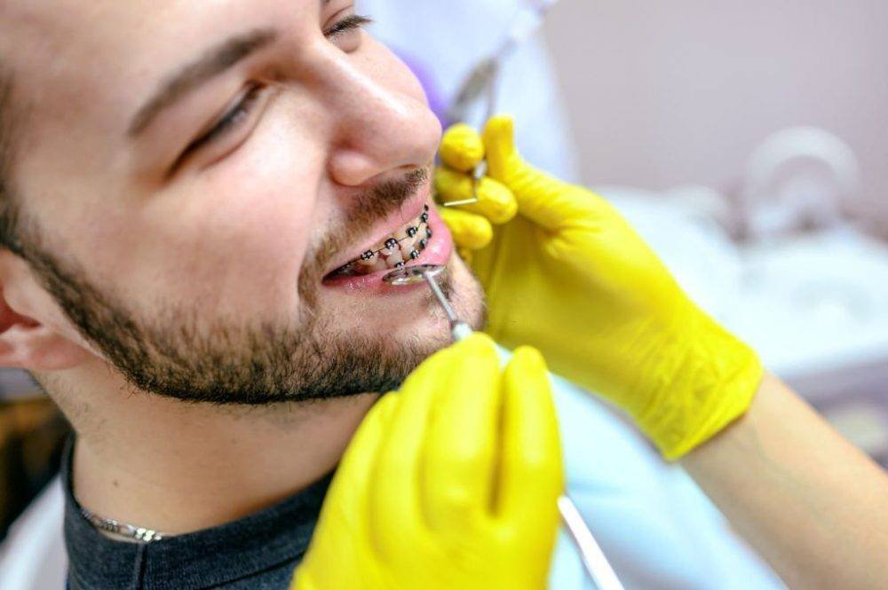 A Complete Guide On Orthodontic Treatment