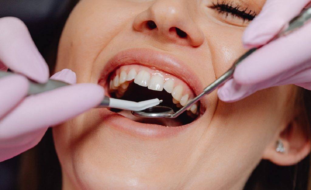 Cosmetic Dental Treatments