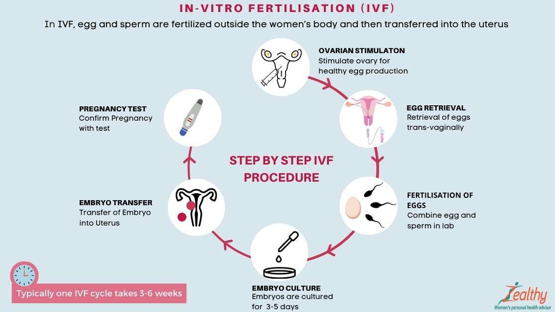 Process of IVF